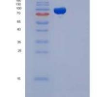 人胚外胚层发育蛋白(EED)重组蛋白His & GST tag