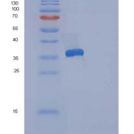 人网钙蛋白3(RCN3)重组蛋白His Tag