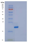 人IL1F5 / IL36RN重组蛋白