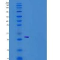 人FGF8a / FGF-8a重组蛋白