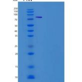 人DPP10 / DPRP3重组蛋白His tag