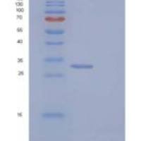 人BPHL重组蛋白His tag