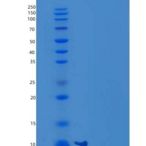 人NCR3/NKp30/CD337重组蛋白C-6His