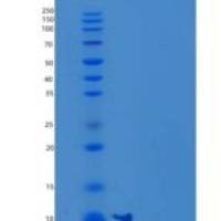 人NCR3/NKp30/CD337重组蛋白C-6His