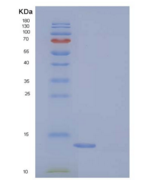 小鼠S100A11 / S100C重组蛋白His tag