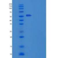 人白介素12受体β1(IL12Rb1)重组蛋白His Tag