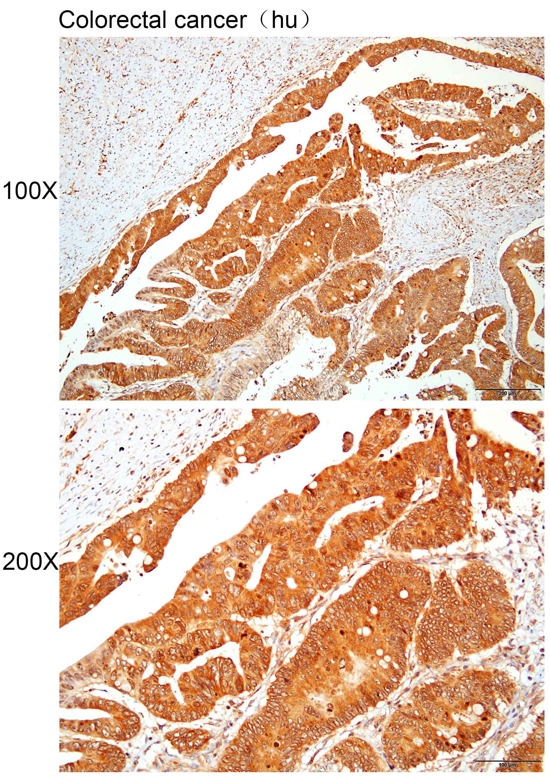 Anti-ADGRG6 Polyclonal Antibod