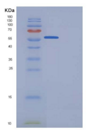 人Granulin / GRN / Progranulin重
