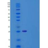 人FLT3L / Flt3 ligand / FLT3LG重组蛋白His tag