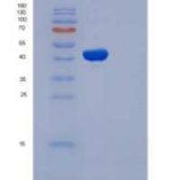 人MYC关联因子X(MAX)重组蛋白His &GST Tag