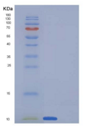 人子宫珠蛋白/ SCGB1A1重组蛋白His tag