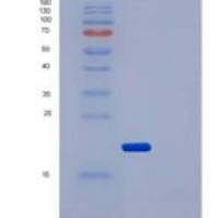 人IL2Ra / CD25重组蛋白His tag