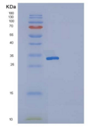 人Osteonectin / SPARC重组蛋白His ta