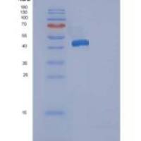 人ACP1 / LMW-PTP重组蛋白GST tag