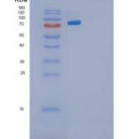 人钙粘蛋白-3/CDH3重组蛋白C-6His