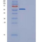 人Granulin / GRN / Progranulin重组蛋白His tag