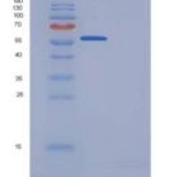 人Granulin / GRN / Progranulin重组蛋白His tag