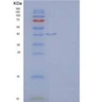 大鼠ICOS / AILIM / CD278重组蛋白Fc tag