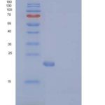 人N6AMT1 / HEMK2重组蛋白His tag