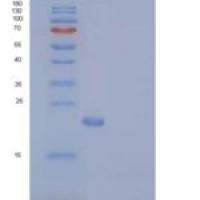 人N6AMT1 / HEMK2重组蛋白His tag