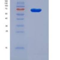 小鼠胰岛素样生长因子结合蛋白2(IGFBP2)重组蛋白Fc Tag