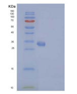 小鼠IL17RA / IL17R / CD217重组蛋白Hi