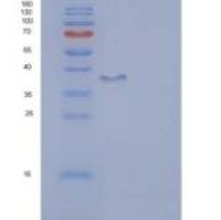 人神经元迁移蛋白双皮质素(DCX)重组蛋白