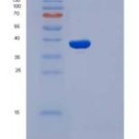 人SELP /选择素P/P-选择素重组蛋白His tag