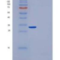 人CUTC / CGI-32重组蛋白His tag