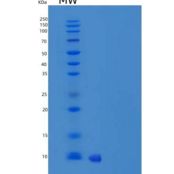大鼠CCL4 / MIP1B重组蛋白His Tag