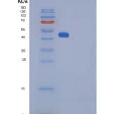 大鼠白细胞介素25 / IL25 / IL17E重组蛋白Fc tag