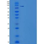 人PBEF / Visfatin / NAMPT重组蛋白His & GST Tag