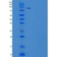 人PBEF / Visfatin / NAMPT重组蛋白His & GST Tag