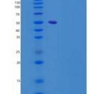 大鼠IL-22R / IL22RA1重组蛋白ECD, Fc Tag