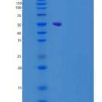 大鼠IL-22R / IL22RA1重组蛋白ECD, Fc Tag