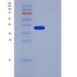 人AKR1A1重组蛋白His tag
