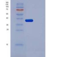 人AKR1A1重组蛋白His tag