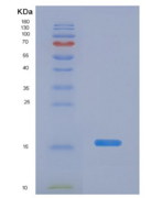 大鼠半乳糖凝集素1(GAL1)重组蛋白