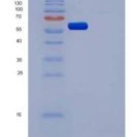 人CSF1R / MCSF Receptor / CD115重组蛋白His tag