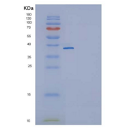 小鼠白介素11受体α(IL11Ra)重组蛋白His tag