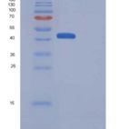 小鼠CD70 / CD27L / TNFSF7重组蛋白Fc Tag