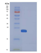 人MANF / ARMET重组蛋白His tag