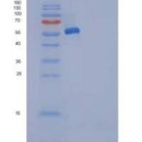 人ANP32A / PHAP1重组蛋白His & GST tag