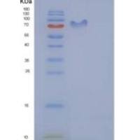 人CD50 / ICAM-3重组蛋白His & Fc tag