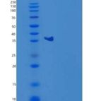 人GPD1/GDP-C重组蛋白C-6His
