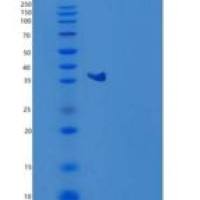 人GPD1/GDP-C重组蛋白C-6His