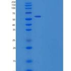 人卵泡抑素/卵泡刺激素重组蛋白Fc tag