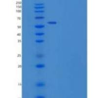 人卵泡抑素/卵泡刺激素重组蛋白Fc tag