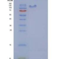 人UBE1 / UBA1重组蛋白His & GST tag