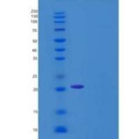 人白介素-28B /干扰素-λ-3重组蛋白His Tag
